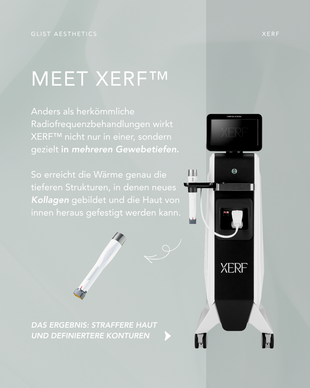  XERF - Impressions - Bild4