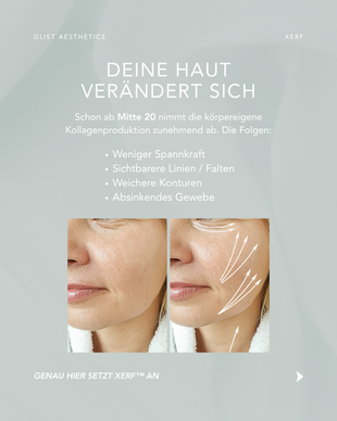  XERF - Impressions - Bild3